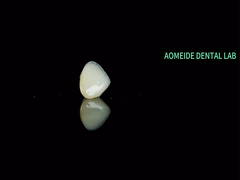 Puente de la corona de cerámica