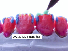 Fortaleza Estética natural Corona de zirconia sólida Perfecto para dientes simples o múltiples