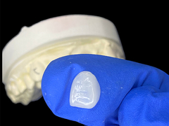 IPS e.max Carillas para incisores en tono A1 Estética natural para sonrisas impecables