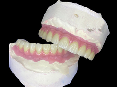 Implantes dentales revolucionarios para una sonrisa completa con estabilidad y comodidad