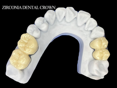 Coroa dental de zirconía para molar