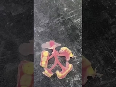 Dentadura parcial flexible de Nesbit para mayor comodidad y durabilidad en la sustitución dental