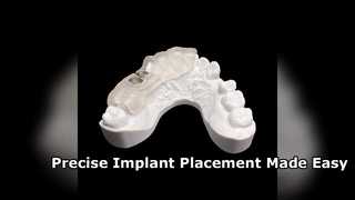 Precision 3D Printed Surgical Implant Guides