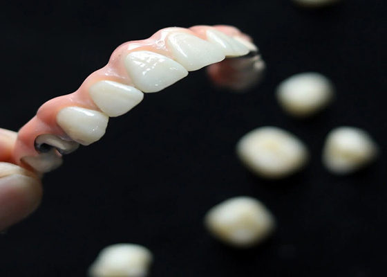 comprar Solución estética Implante dental Puente de corona para adultos que reemplaza los dientes perdidos online manufacture