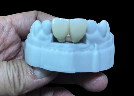 comprar Reemplazar la corona de implantes dentales con una base de titanio y una corona de zirconio. online manufacture