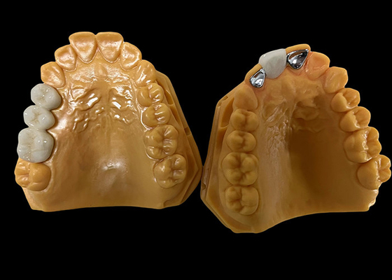 comprar Porcelana de translucidez moderada fundida con metal corona PFM, corona cerámica PFM online manufacture