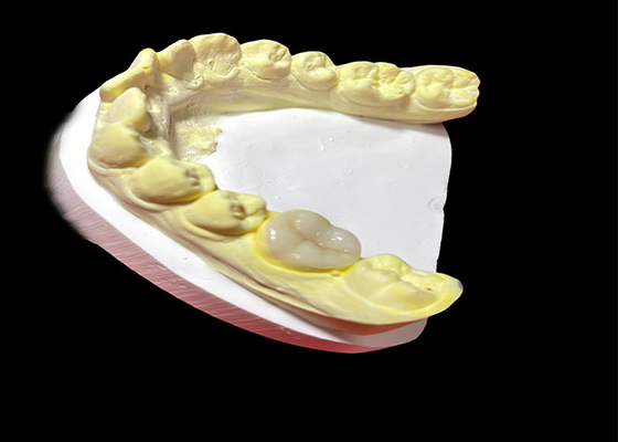 comprar Enlaces y incrustaciones de cerámica de alta calidad para la restauración dental sin costuras y de larga duración online manufacture