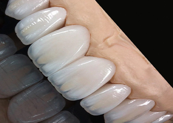 comprar Puente de corona de cerámica translúcida resistente a manchas, adecuado para una sonrisa natural online manufacture