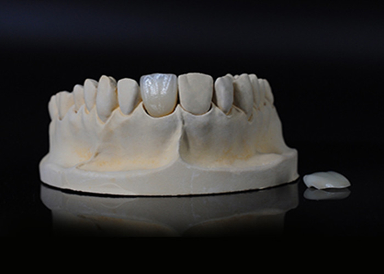 comprar Porcelana translúcida con chapa Emax para un ajuste excelente / estética natural online manufacture