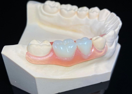 comprar OEM Dentes invisibles extraíbles Prótesis dental parcial de resina acrílica a medida online manufacture