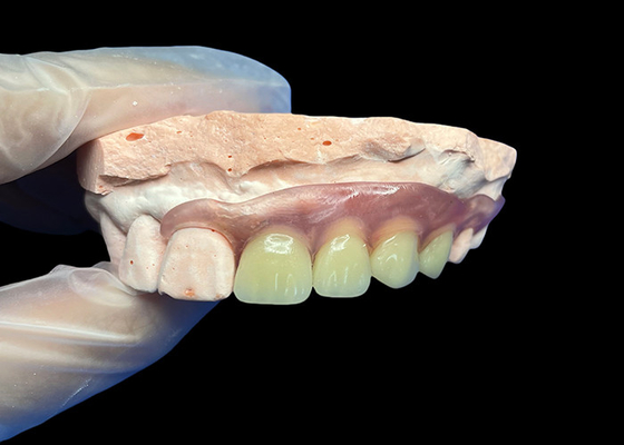 comprar Dentaduras parciales invisibles flexibles para un ajuste cómodo y seguro y una estética natural online manufacture