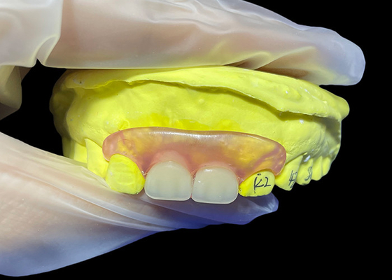 comprar Sustitución de dentadura parital flexible para masticar y hablar cómodamente online manufacture