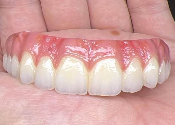 comprar Salud Oral Implante dental Dentaduras con soporte Puente Superficie pulida Soporte de dentaduras completas online manufacture