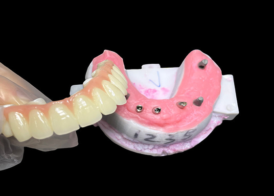 comprar Implante con apoyo de arco completo Dentadura fija Implante dental Puente de corona de cerámica online manufacture