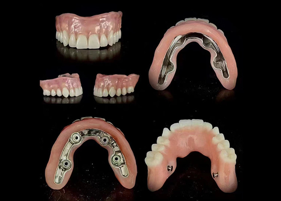 comprar Implante de barra de precisión con apoyo de dentadura híbrida ajuste seguro estabilidad ajustable online manufacture