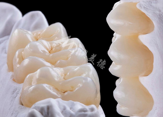 comprar Coronas dentales de zirconia de alta resistencia para reemplazo de dientes simples o múltiples online manufacture