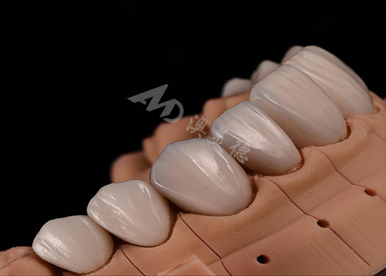 comprar Fortaleza Estética natural Dientes Coronas de zirconia para una resistencia a las astillas de ajuste preciso online manufacture