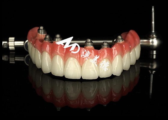 comprar Implante dental personalizado con apoyo de prótesis dentales Puente de la corona para el mantenimiento de dientes faltantes online manufacture