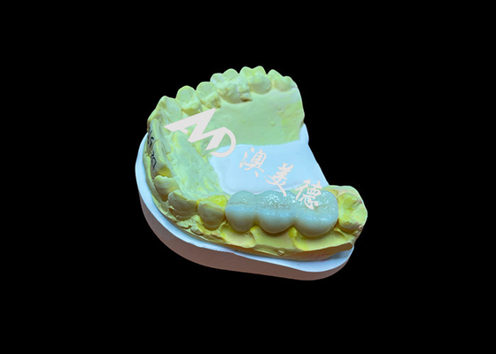 comprar Superficie lisa de zirconia personalizada Corona dental Alta biocompatibilidad Resistencia a las manchas online manufacture