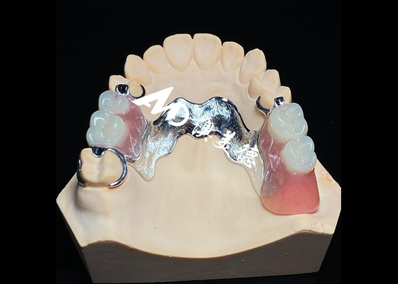 comprar Dentadura extraíble con marco de metal fundido para una resistencia y estabilidad superiores con una comodidad duradera online manufacture