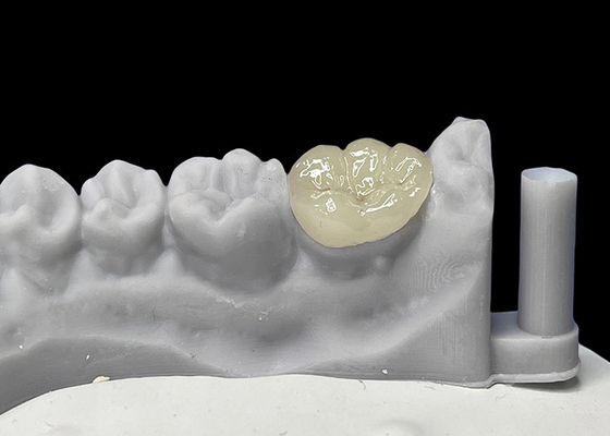 comprar Enlaces cerámicos dentales de ajuste preciso, enlaces de porcelana y enlaces aprobados por la FDA. online manufacture