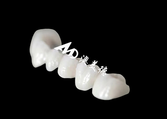 comprar Una corona dental de Zriconia de arco completo con una apariencia natural asombrosa online manufacture