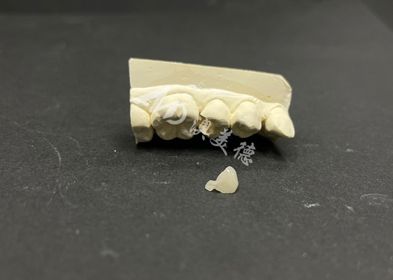 comprar Incremento de cerámica Emax hipoalergénico resistente a manchas para la reparación precisa de dientes dañados online manufacture