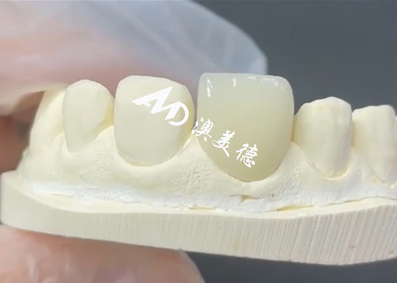 comprar Veneer EMAX duradero y estético La solución perfecta para restauraciones de porcelana online manufacture