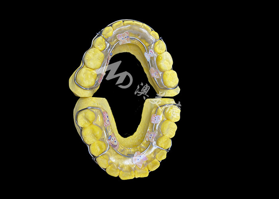 comprar Retenor de Beagle para una retención eficaz de la sonrisa y una alineación duradera online manufacture