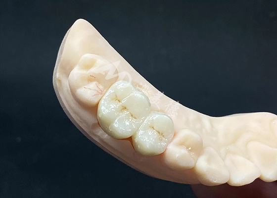 comprar Corona de zircónia de alta translucidez de aspecto natural con resistencia a las astillas online manufacture