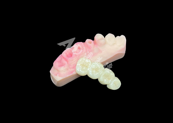 comprar Puente superior de corona de zirconio sólido para una estética dental de aspecto natural online manufacture