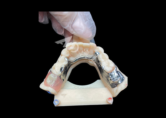 comprar Dentes parciales fundidos de fácil mantenimiento para una resistencia superior y atractivo estético online manufacture