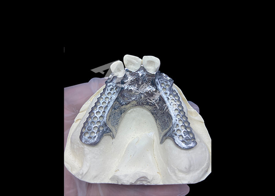 comprar Fácil de ajustar Custom Cast Partial Denture Marco estable y de aspecto natural para resultados rápidos online manufacture