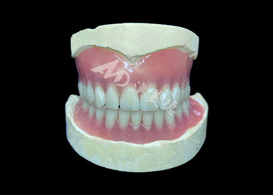 comprar Dentaduras parciales de fundición a medida, fáciles de limpiar, ideales para restaurar la capacidad de masticar y las sonrisas online manufacture