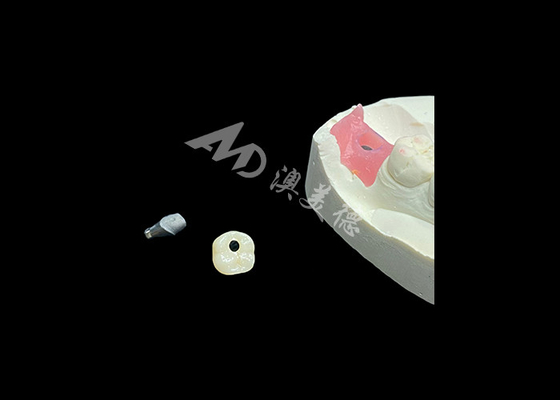 comprar Las coronas de implantes dentales de larga duración revolucionan el procedimiento de odontología restaurativa online manufacture