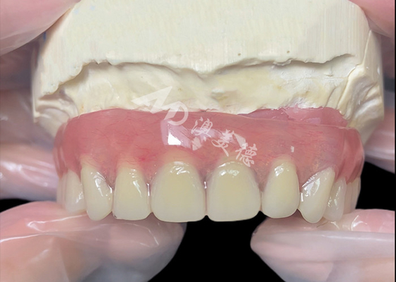 comprar Implante de titanio con apoyo de barra de adhesión Dentaduras dentales de laboratorio dental china online manufacture