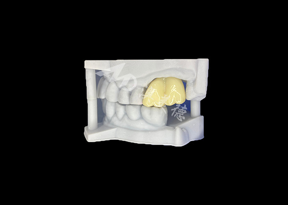 comprar Corona dental de zirconio sólido Durabilidad garantizada Molar de laboratorio dental de China online manufacture