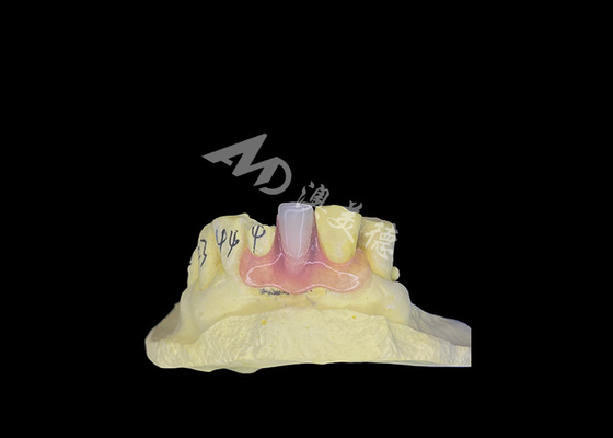 comprar Dentadura parcial flexible de Nesbit para mayor comodidad y durabilidad en la sustitución dental online manufacture