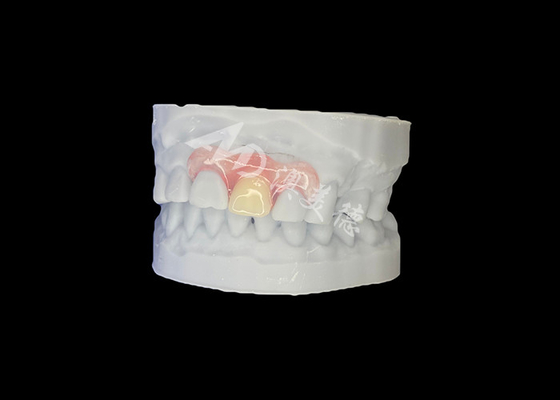 comprar Dentadura parcial flexible de Nesbit personalizada para ajuste natural y confort duradero online manufacture