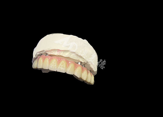 comprar Dentes postizos con implantes Estabilidad Comodidad y sonrisa natural online manufacture