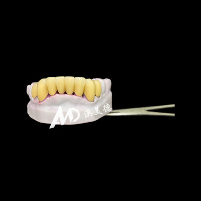 comprar Corona dental duradera de zircónia con núcleo de post de metal para restauración de dientes fuertes y de aspecto natural online manufacture