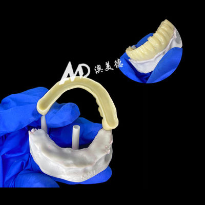 comprar Puente de implante provisional PMMA con interior hueco para estabilidad y curación natural, fabricación CAD/CAM de alta precisión, material PMMA biocompatible online manufacture