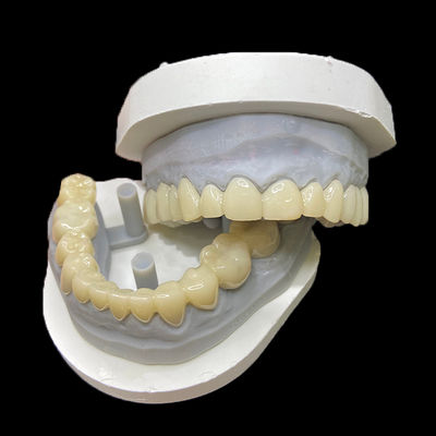 comprar PMMA Restauraciones temporales CAD/CAM PMMA Coronas y puentes para cajas dentales provisionales online manufacture