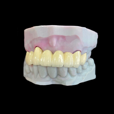 comprar Porcelana fundida a metal (PFM) con marco Co-Cr online manufacture