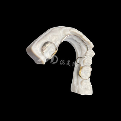 comprar Arco lingüístico personalizado con bandas Aplicación de ortodoncia para mantenimiento del espacio y alineación dental online manufacture