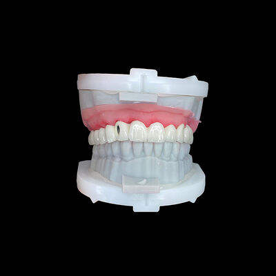 comprar Puente de implante de arco completo con estructura metálica de CoCr de alta resistencia y estratificación de porcelana premium para un ajuste de precisión online manufacture