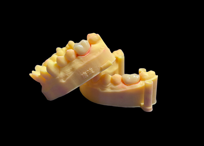 Corona dental de porcelana de zirconio de primera calidad Fuerza inigualable Precisión de ajuste y estética y durabilidad excepcionales