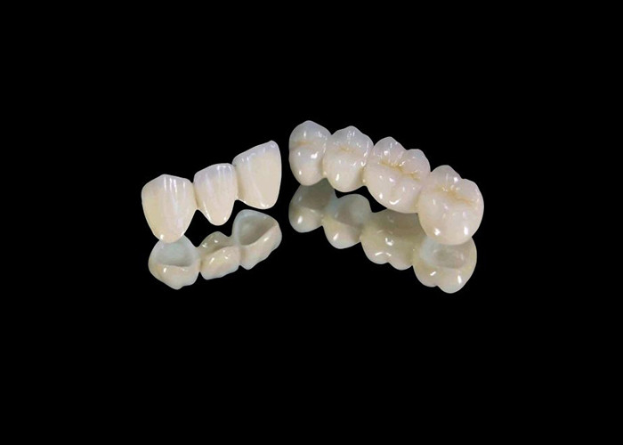 Corona dental de zircónia resistente al desgaste con resistencia a las astillas y manchas y estética natural de laboratorio dental de China