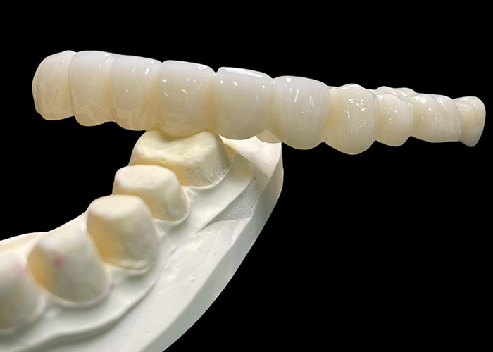 Vita Clásico de sombra todo cerámico puente de la corona natural buscando restauración dental
