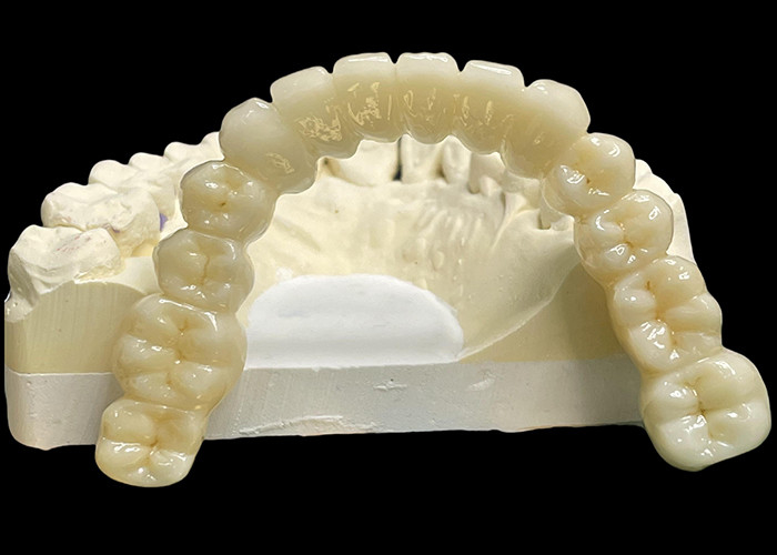 Vita Clásico de sombra todo cerámico puente de la corona natural buscando restauración dental
